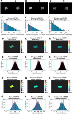 A highly generalized classifier for osteoporosis radiography based on multiscale fractal, lacunarity, and entropy distributions